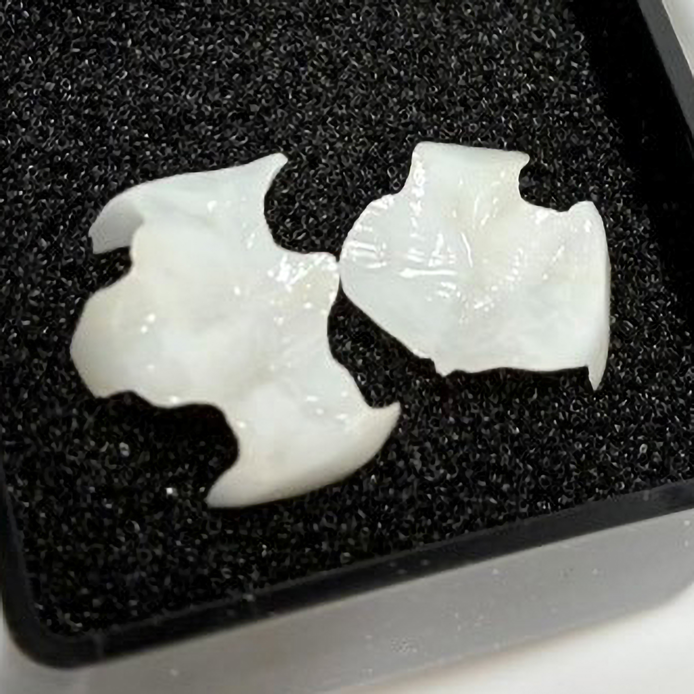 セラミック治療イメージ