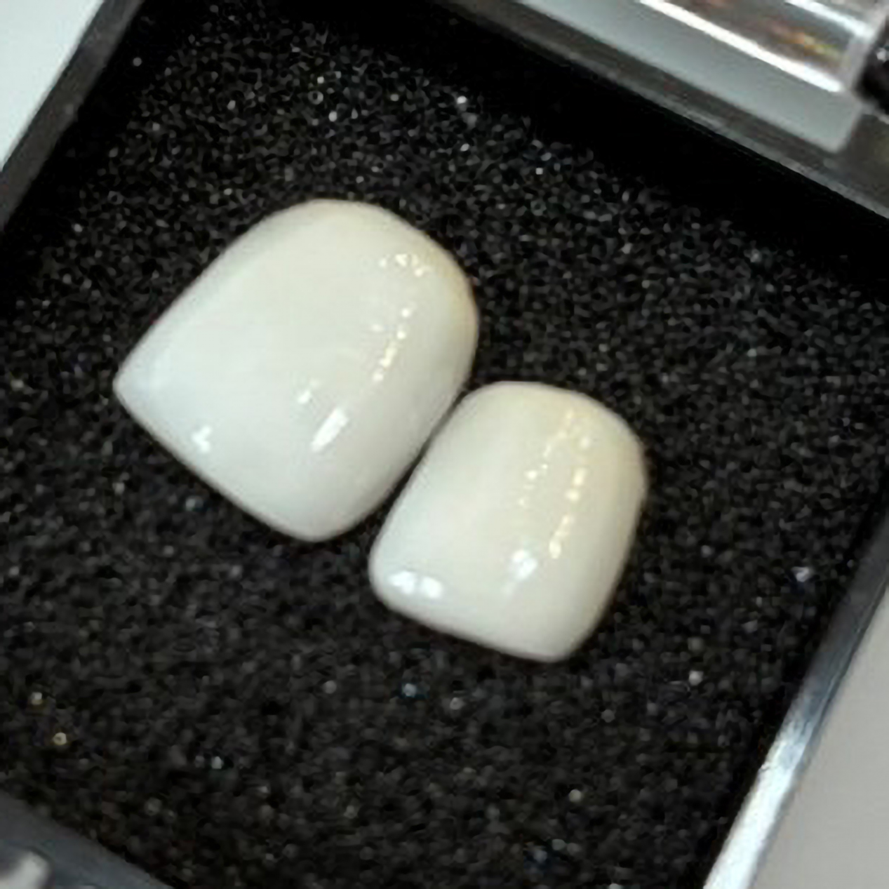 ラミネートベニア